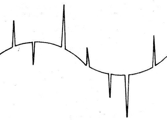    Figura 5 - Pulsos sobrepuestos a una señal senoidal (transitorios)
