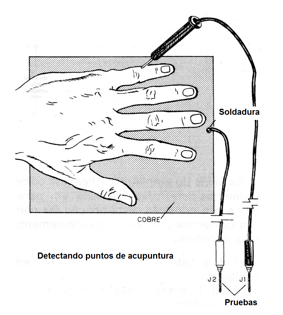 Figura 2 - Uso de puntos de acupuntura
