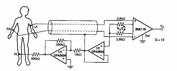 ECG con conexión de pierna 
